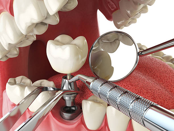 Best Emergency Cosmetic Dentistry in Le Grand, CA